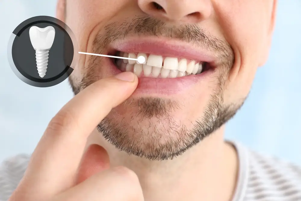 happy man with a dental implant west sacramento